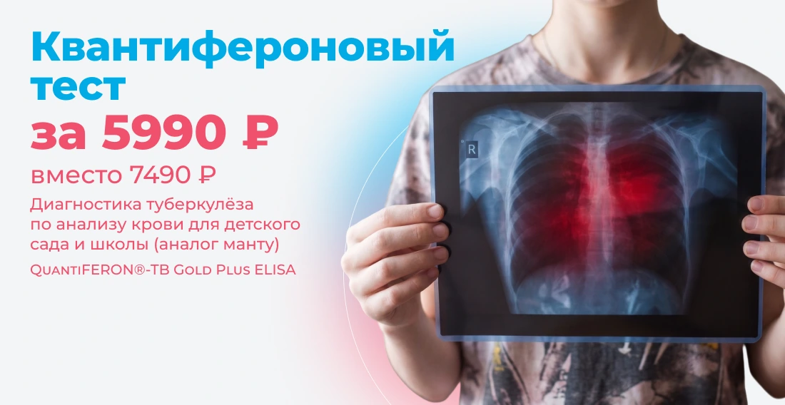 Диагностика туберкулёза по анализу крови для детского сада и школы